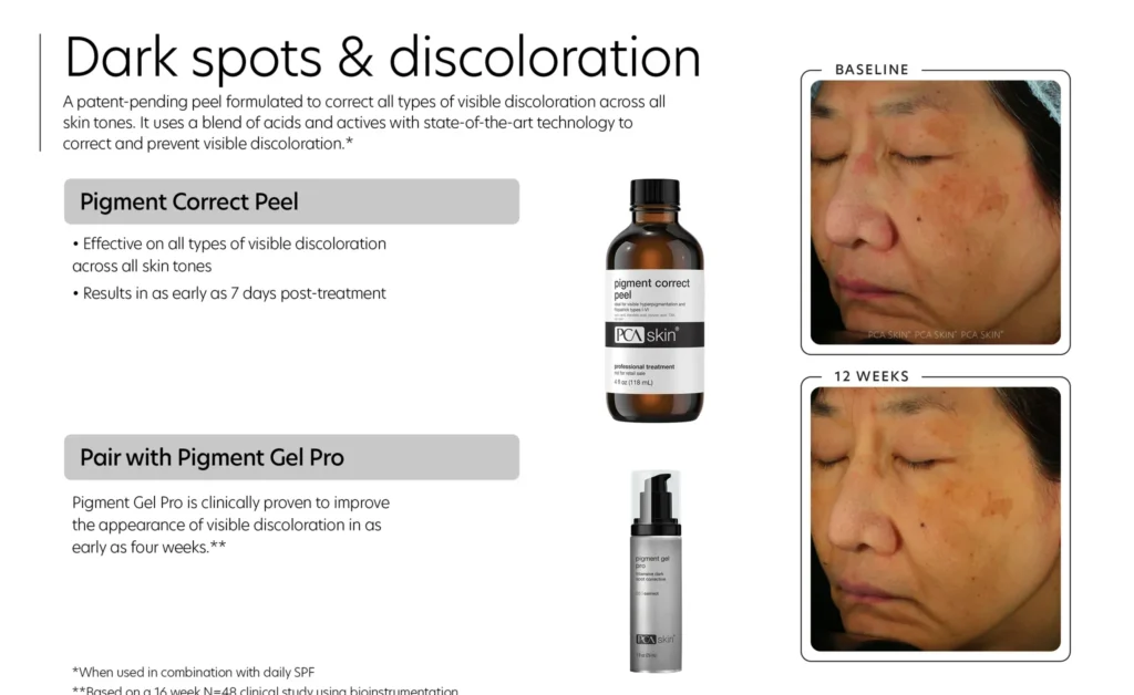 It’s PCA National Peel Day at H2O Salon & Spa – Don’t Miss It - h2o salon and spa